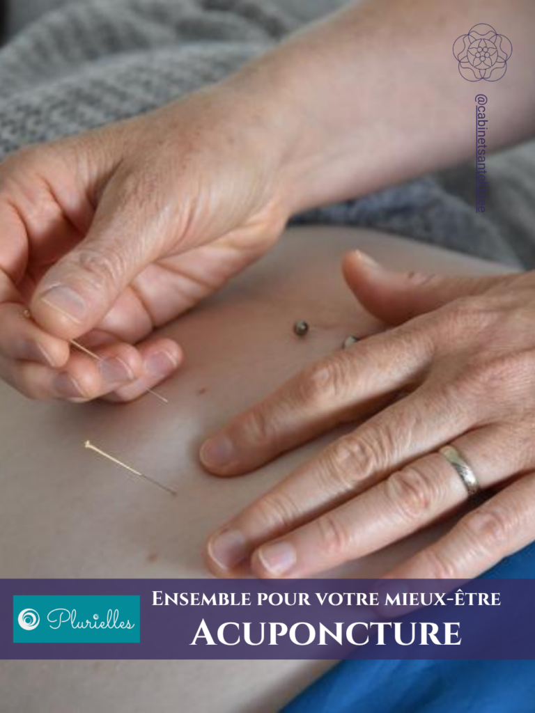 séance d'acuponcture chez Mélanie Ciejak, acuponctrice et sage-femme à Villars-sur-Glâne (Fribourg)